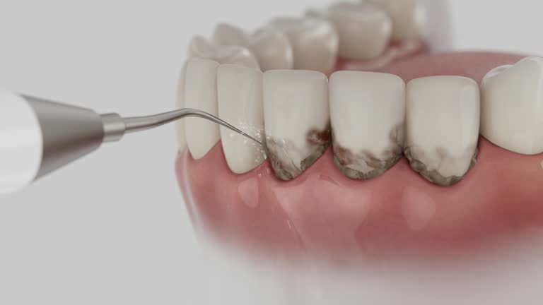 Reliable Dental Implants contractor in Roland, OK by Smile Center Dentistry